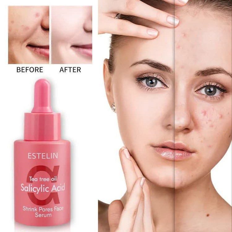 سرم روغن چای وسالسلیک اسید استیلن
