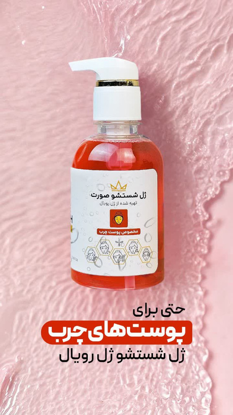 ژل شستشوی رویال پوست چرب
